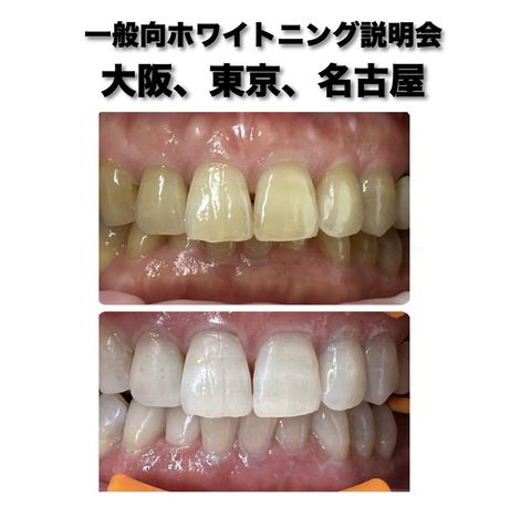 Fascia Re:life 佐藤青児 リライフ 佐藤青児 著 Re:Life 奇跡の治療法 FASCIA