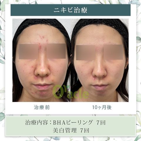 オラクル美容皮膚科 | LINE Official Account