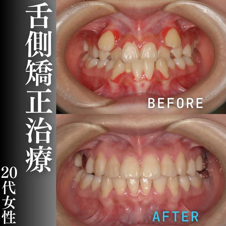 Amazon.co.jp: 舌側矯正: Dr.Gormanテクニック : ジョン・C.ゴ