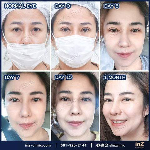 Mixed media feed | inZ Surgery | LINE Official Account