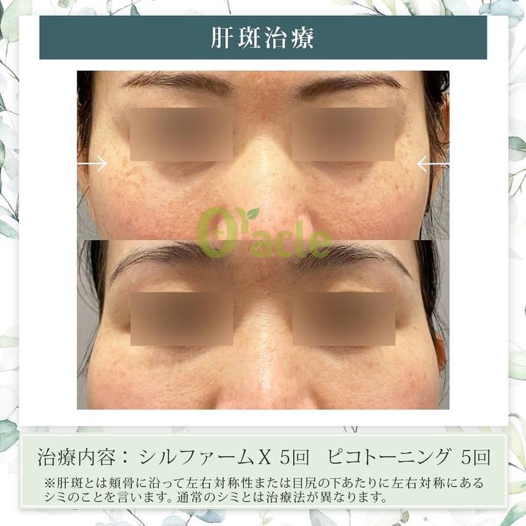 Mixed media feed | オラクル美容皮膚科 | LINE Official Account