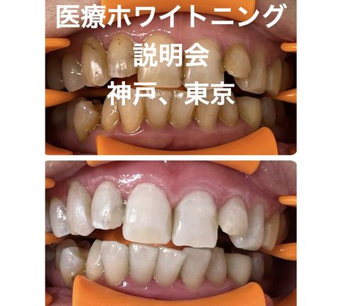 佐藤青児【さとう式リンパケア公式】 | LINE Official Account