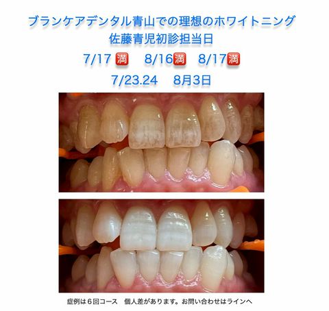 【美品】さとう式リンパケア　DVDセット　佐藤青児 Amazon.co.jp: 見て学ぶさとう式リンパケア☆(DVD)☆: 施術家