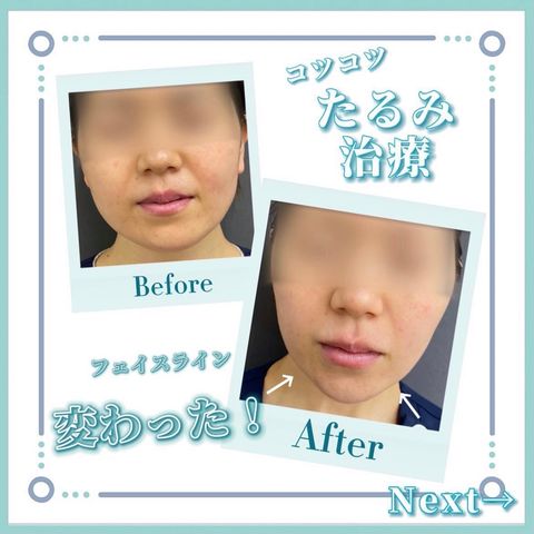 オラクル美容皮膚科 | LINE Official Account