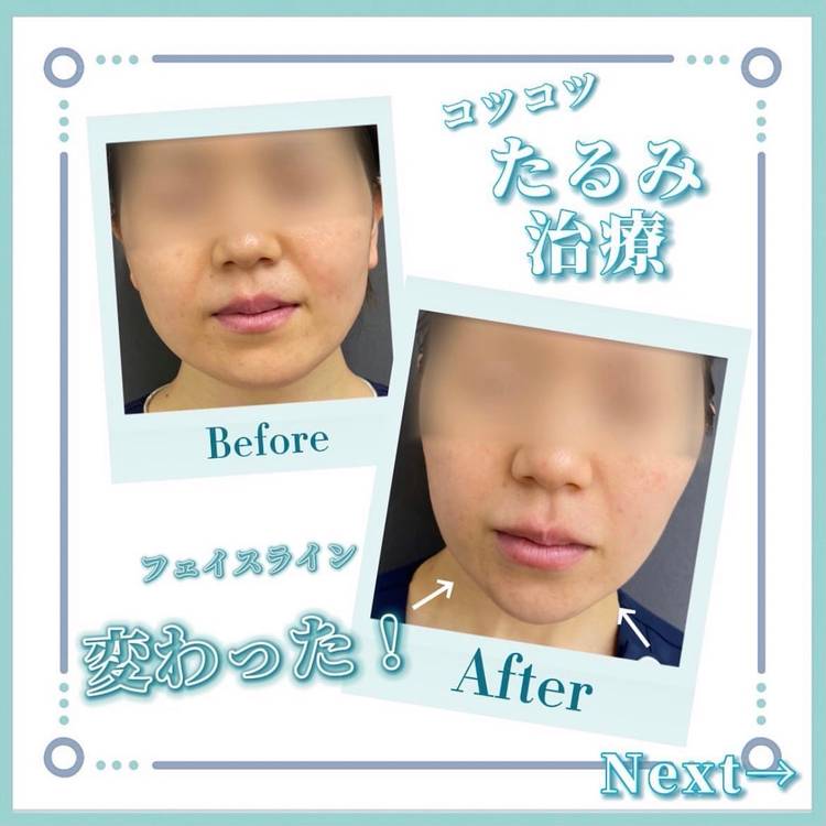 Mixed media feed | オラクル美容皮膚科 | LINE Official Account